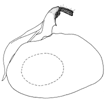 vitrea a.GIF (3024 Byte)
